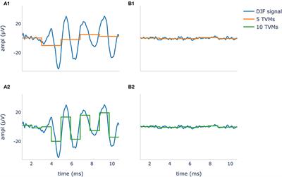 Objectification of intracochlear electrocochleography using machine learning